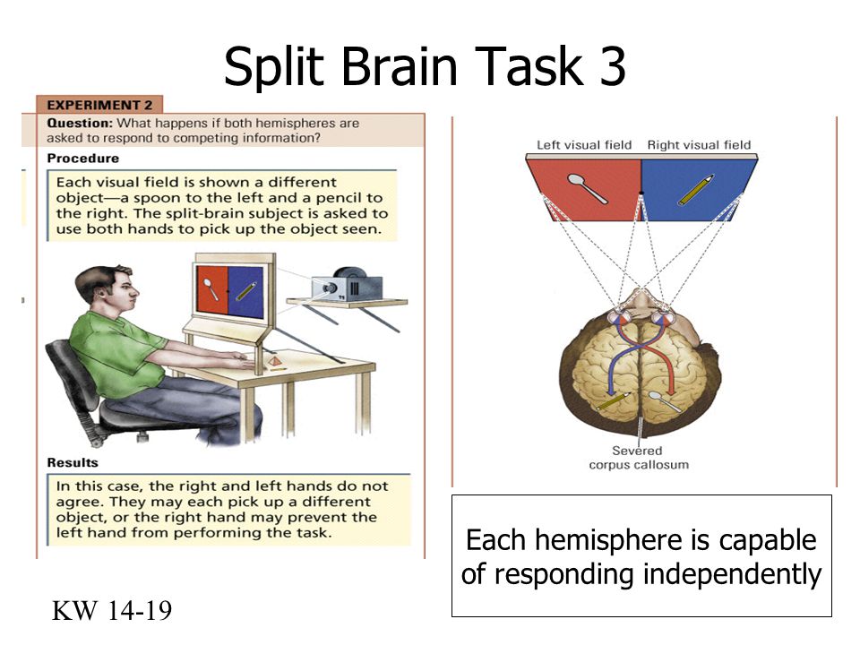 Human Brain - Neuroscience - Cognitive Science
